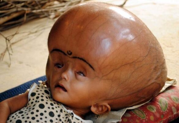 Scientists discover abnormally large skull of ‘lost’ human species in Asia – Science News – WION